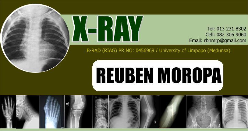 X-Ray Reuben Moropa